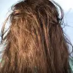 Predoziranje z beljakovinami: zakaj obnovitvena kozmetika povzroča krhkost las Predoziranje z beljakovinami: zakaj obnovitvena kozmetika povzroča krhkost las